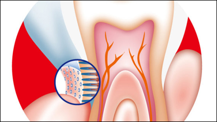 Dental internal vector